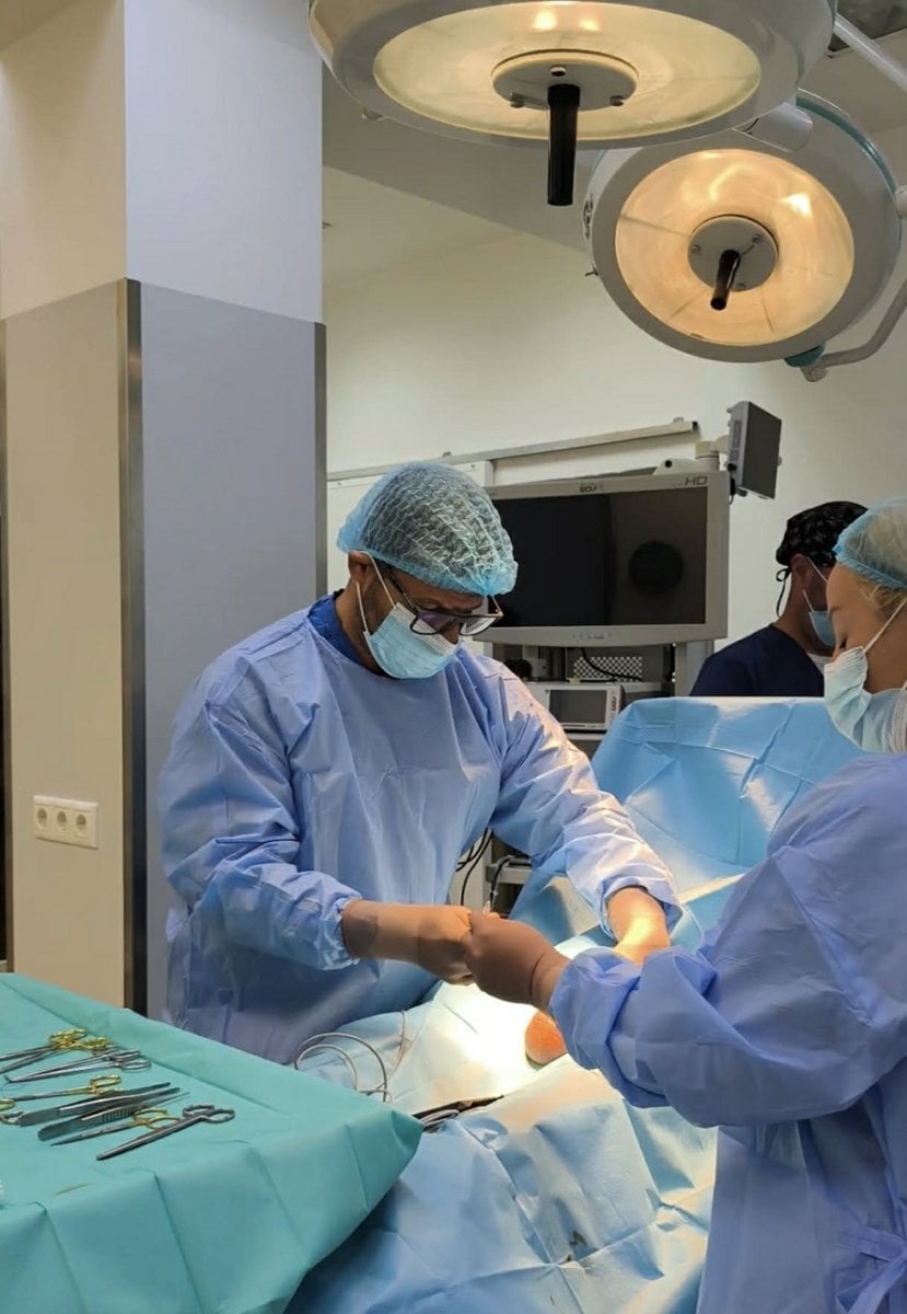 before-after photo