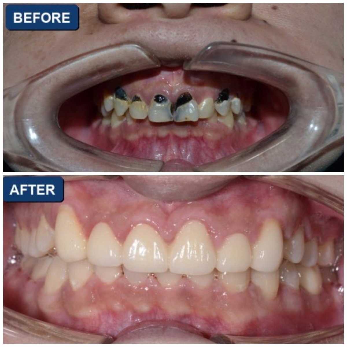 before-after photo