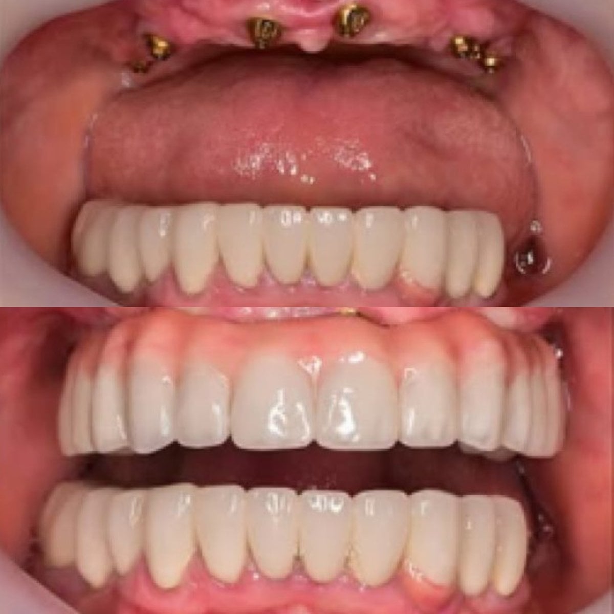 before-after photo