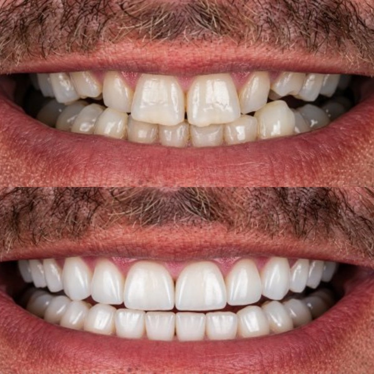 before-after photo