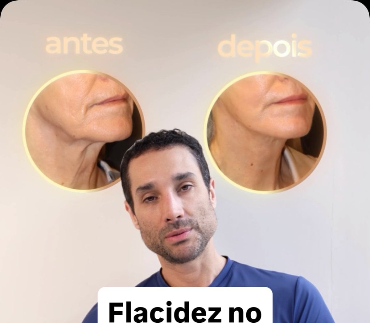 before-after photo
