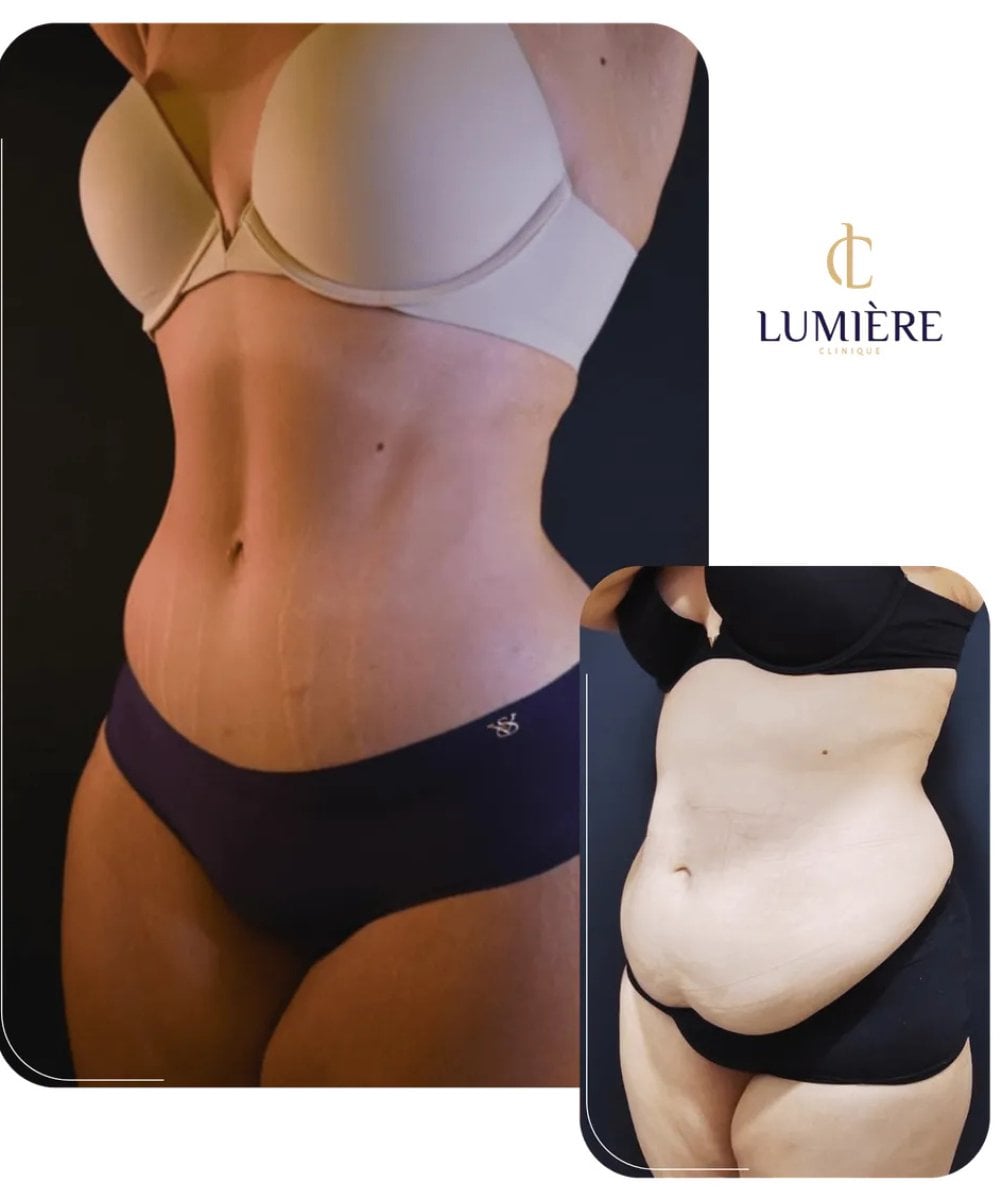before-after photo