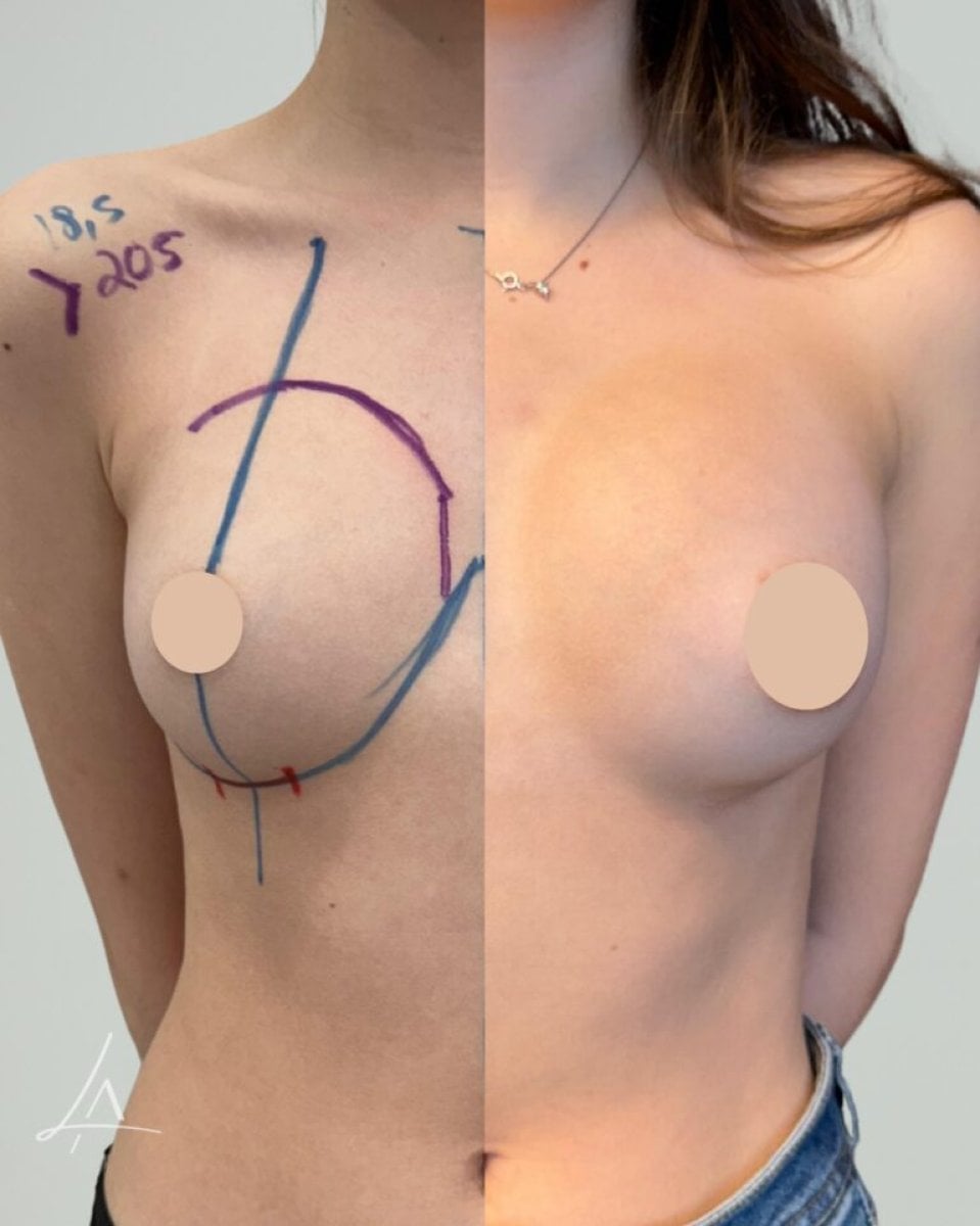 before-after photo