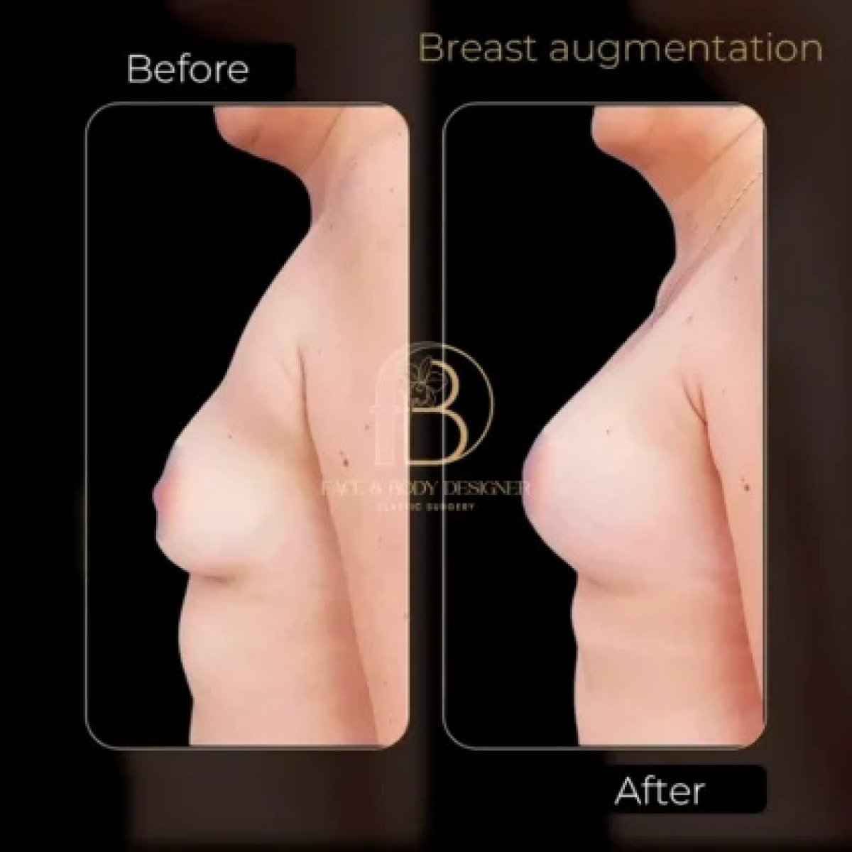 before-after photo