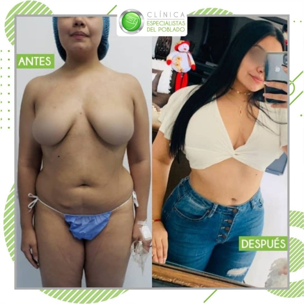 before-after photo