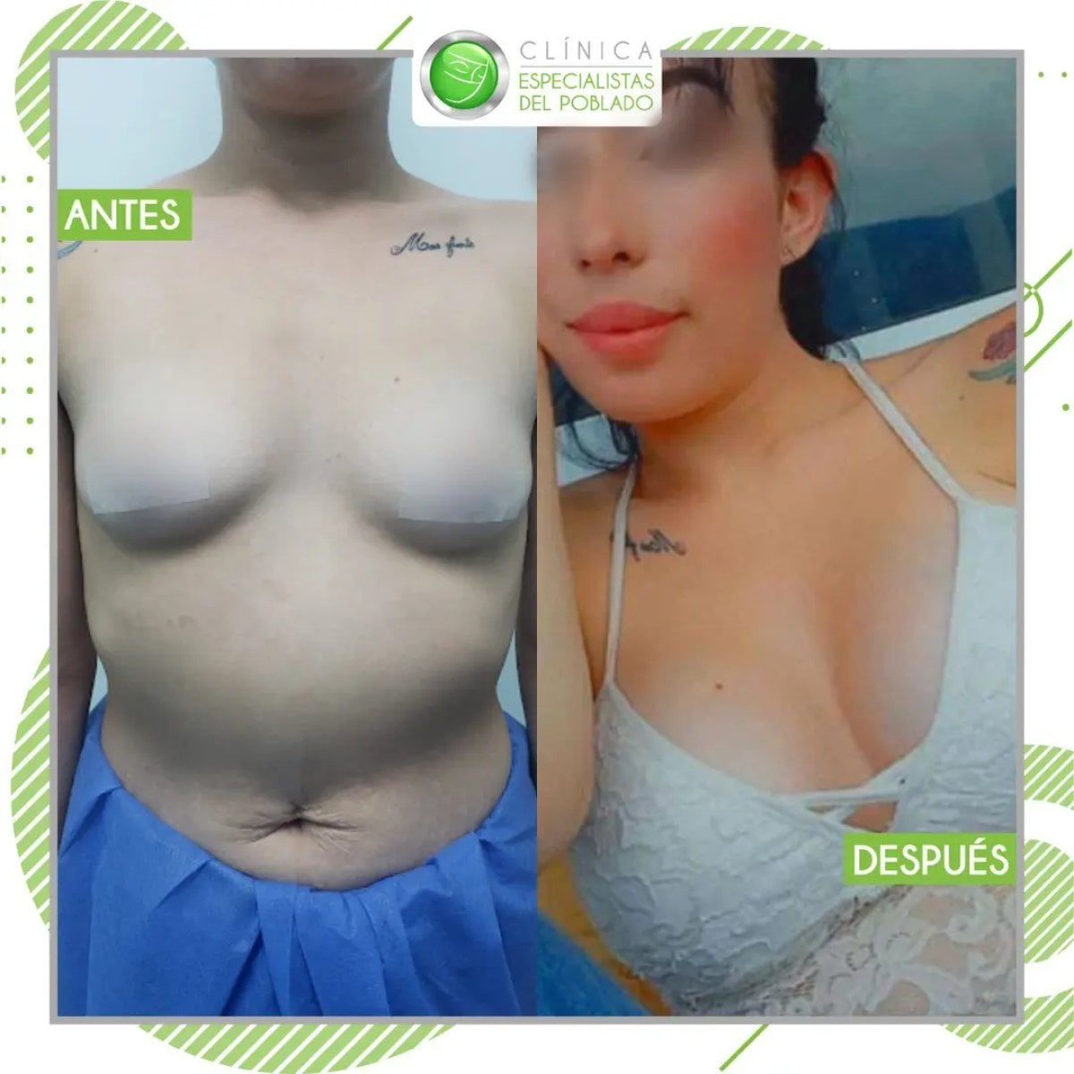 before-after photo