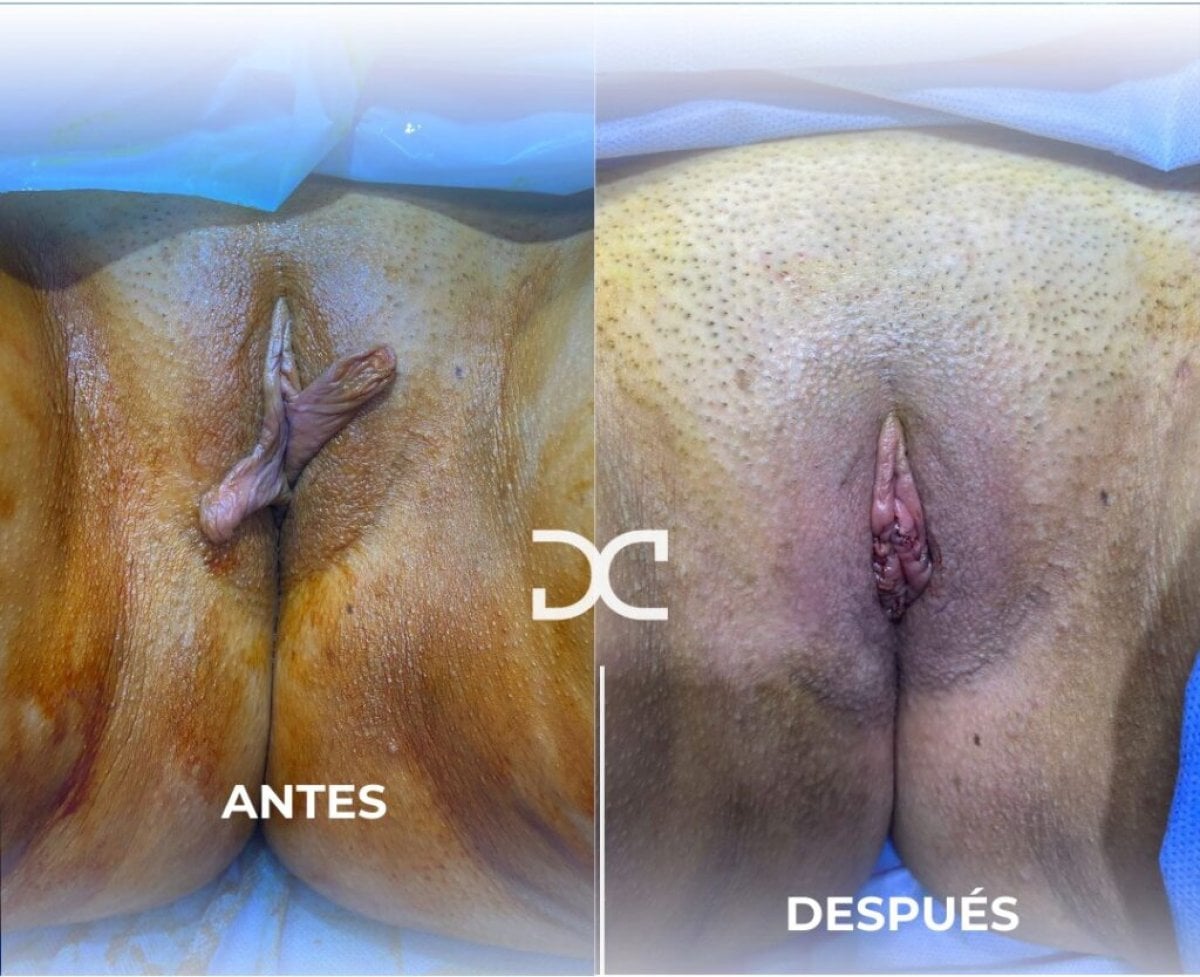 before-after photo