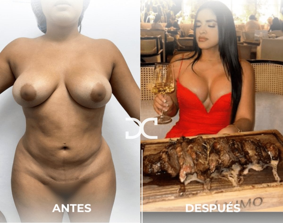 before-after photo