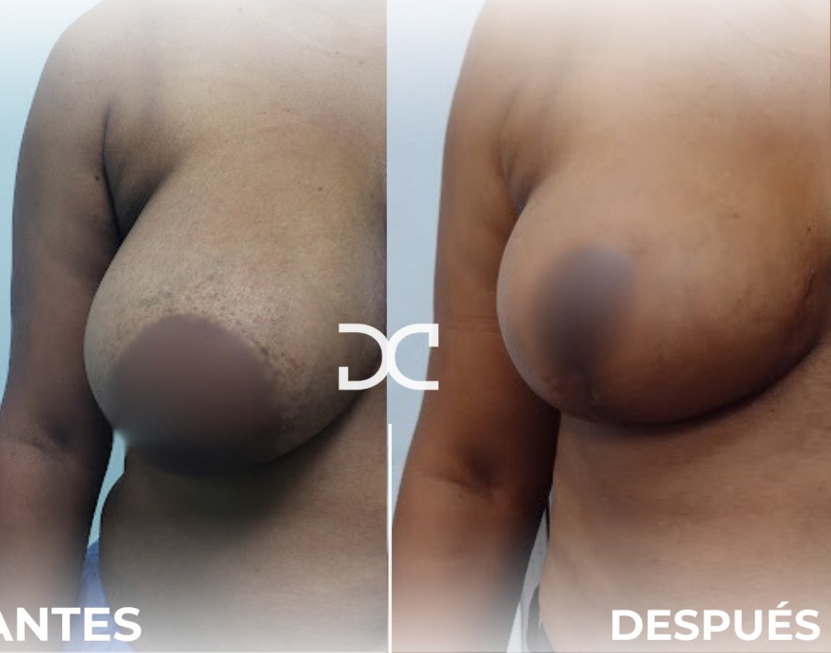 before-after photo