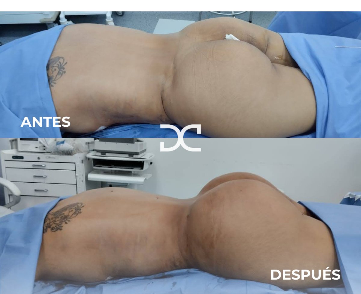 before-after photo