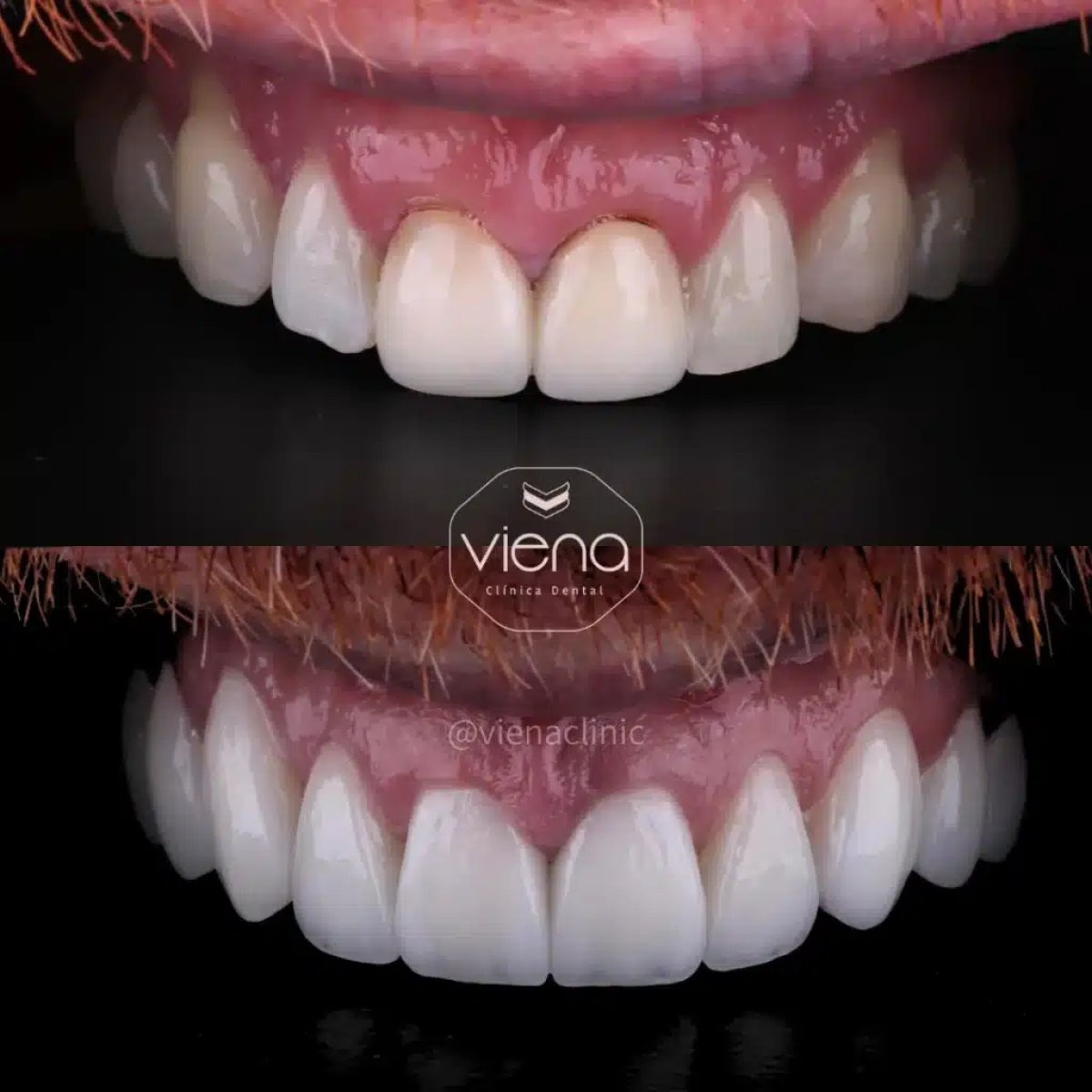 before-after photo