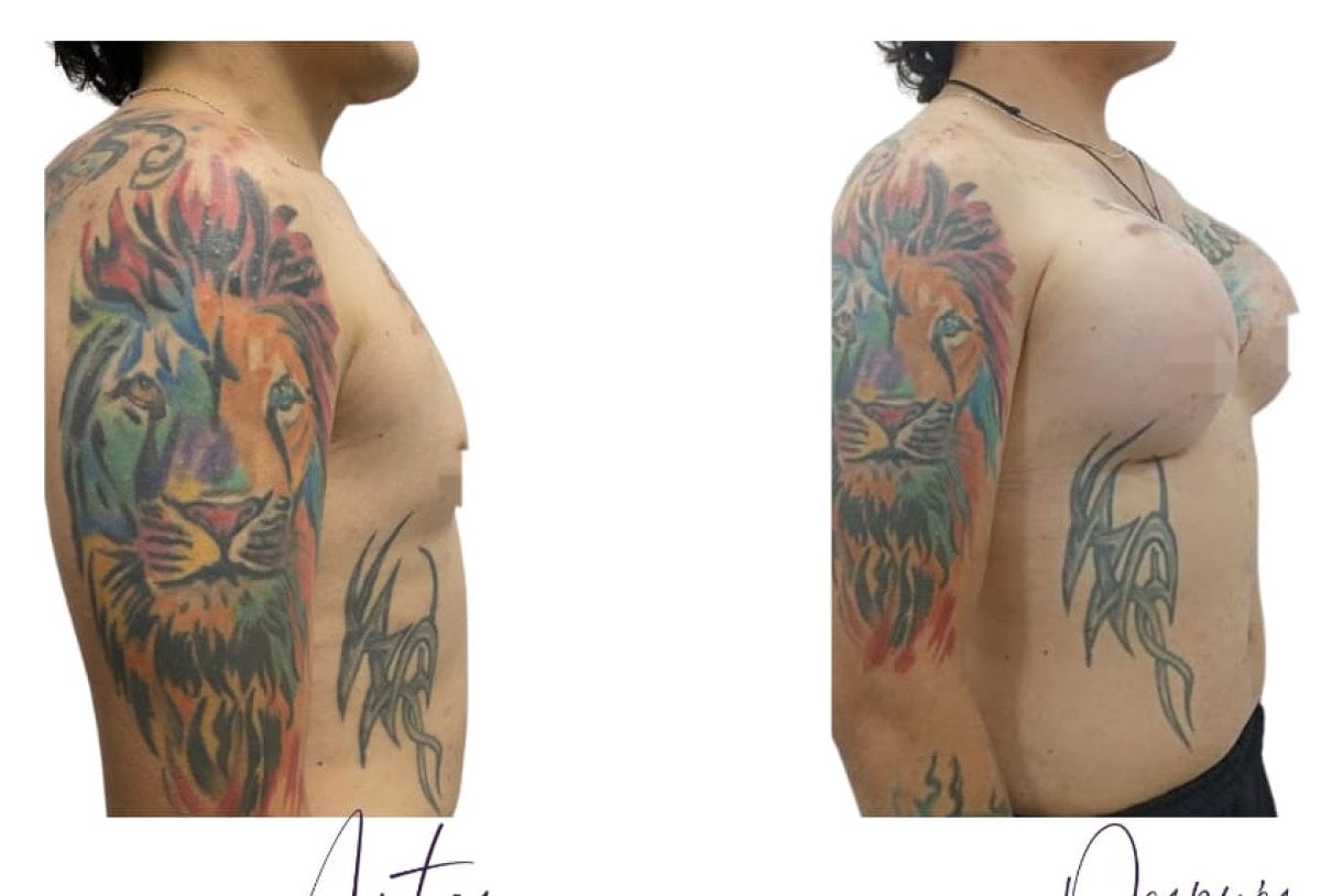 before-after photo