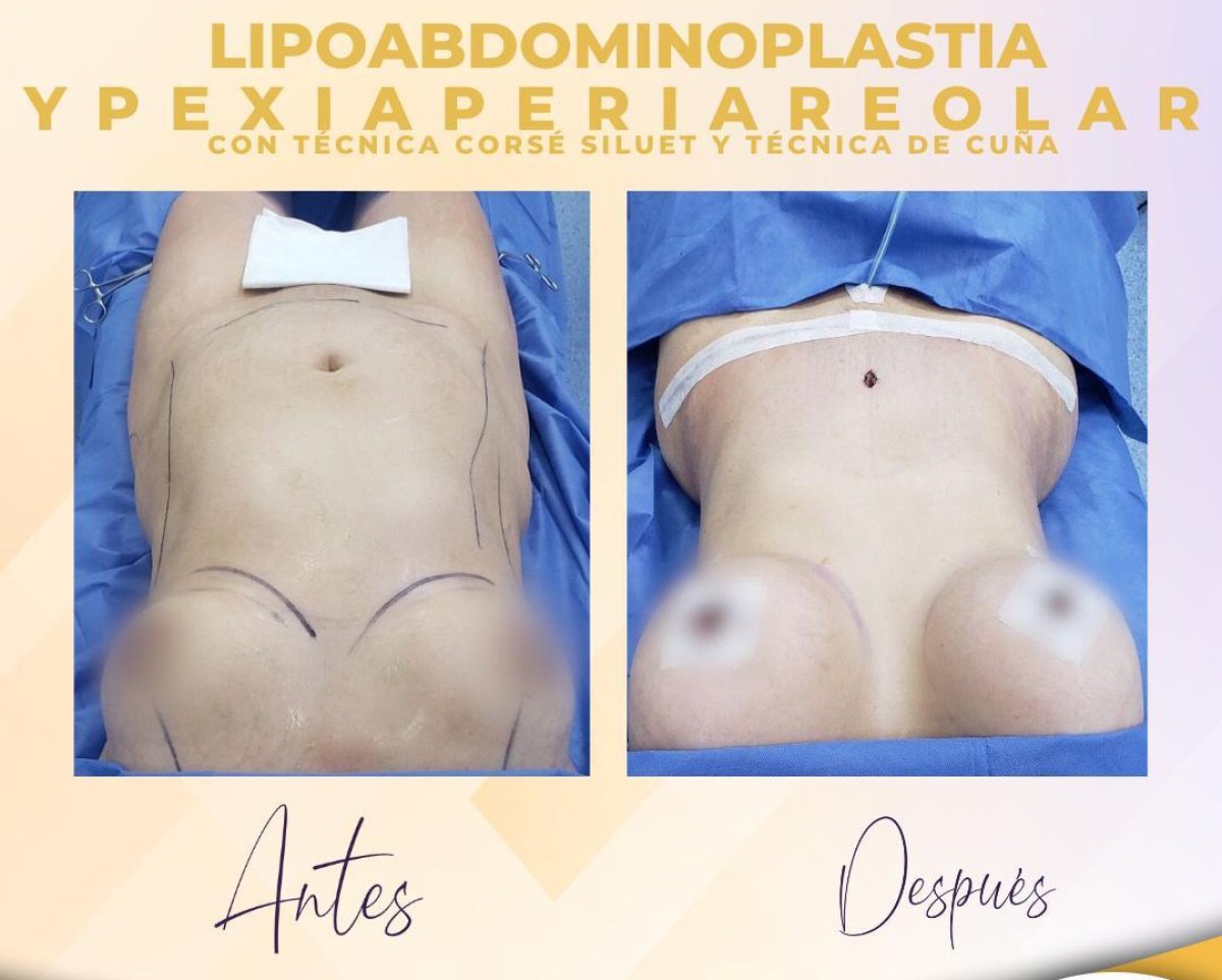 before-after photo