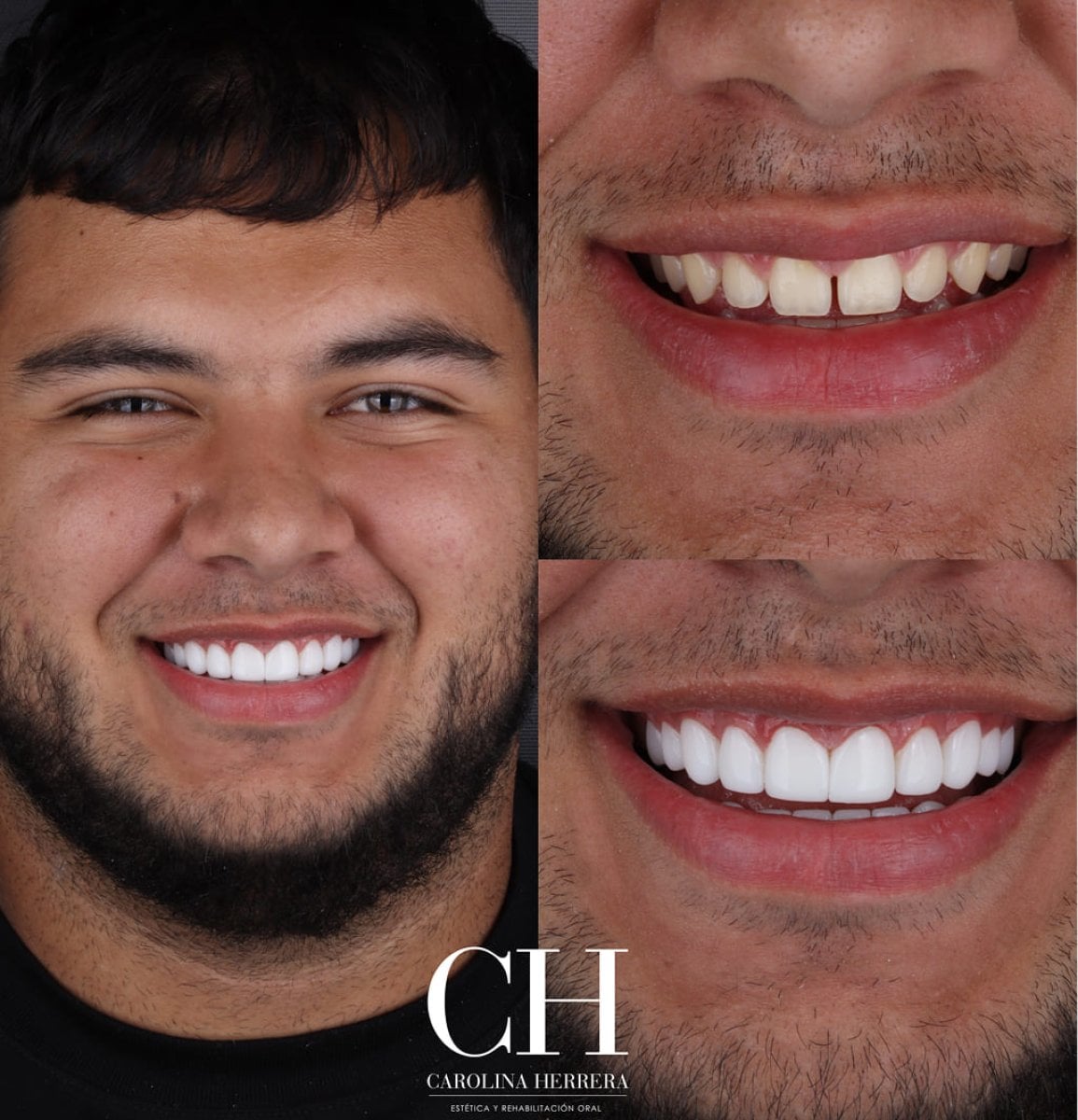 before-after photo