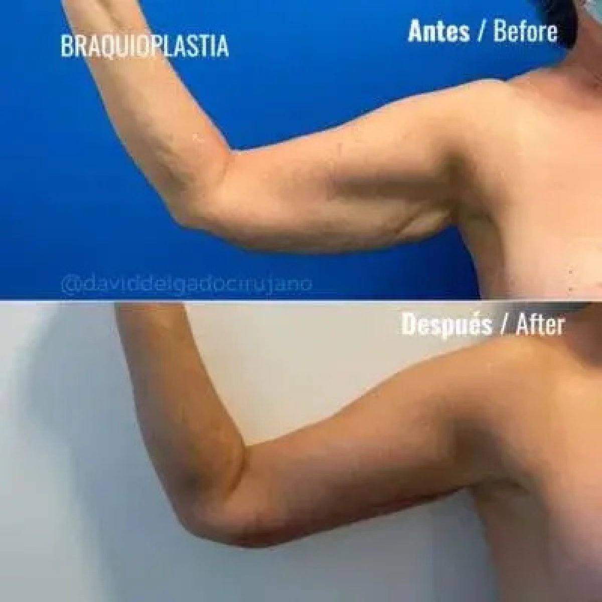 before-after photo