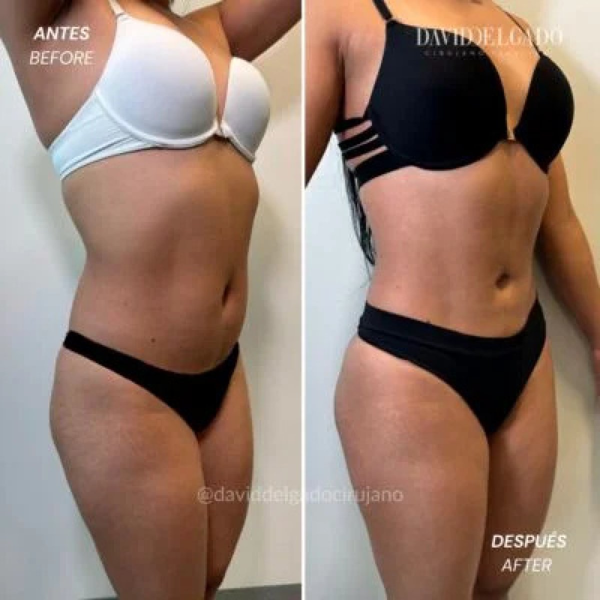 before-after photo