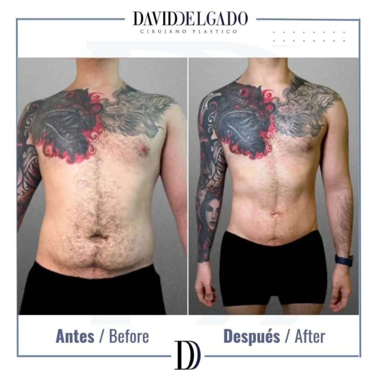 before-after photo