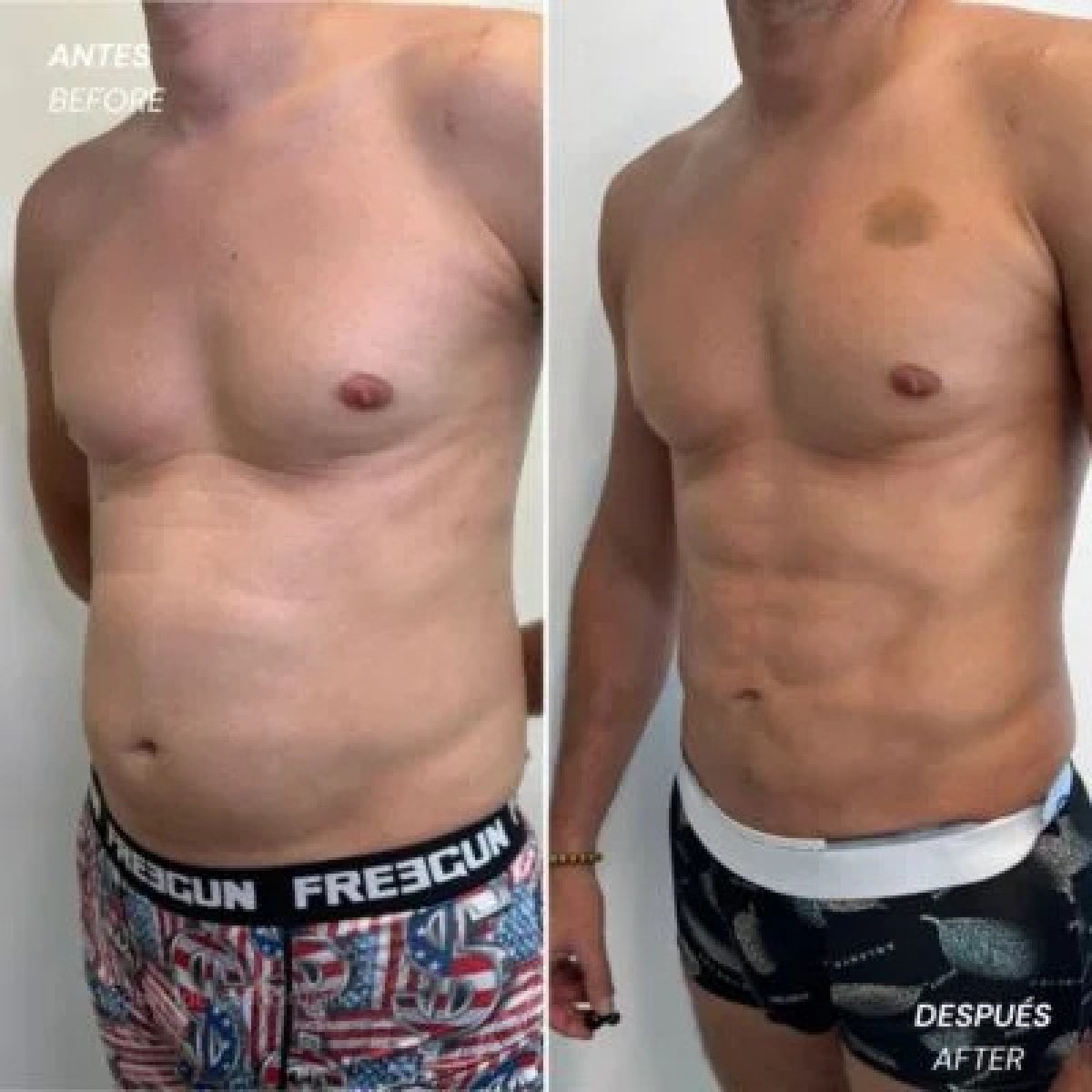 before-after photo