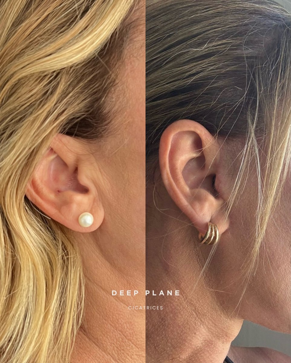 before-after photo