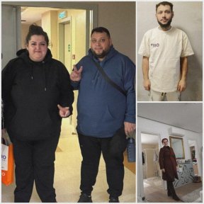 Before and after gastric sleeve surgery results at Optimed International Hospital, weight loss