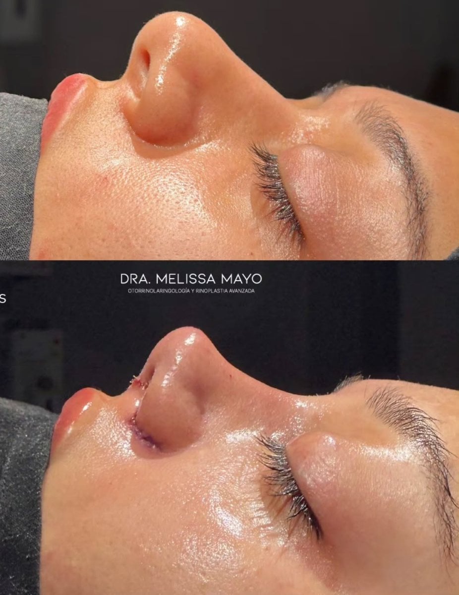 before-after photo