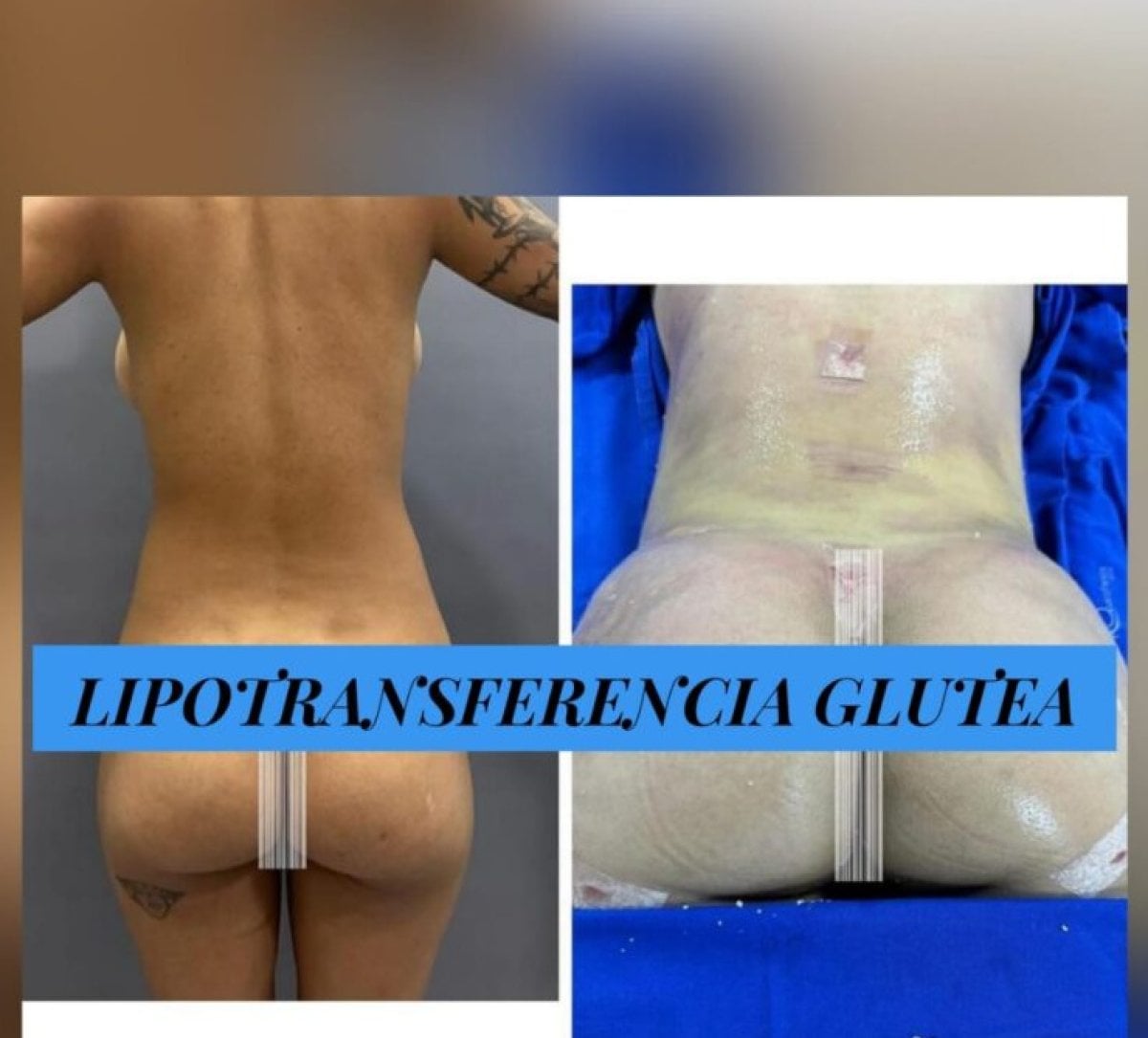 before-after photo