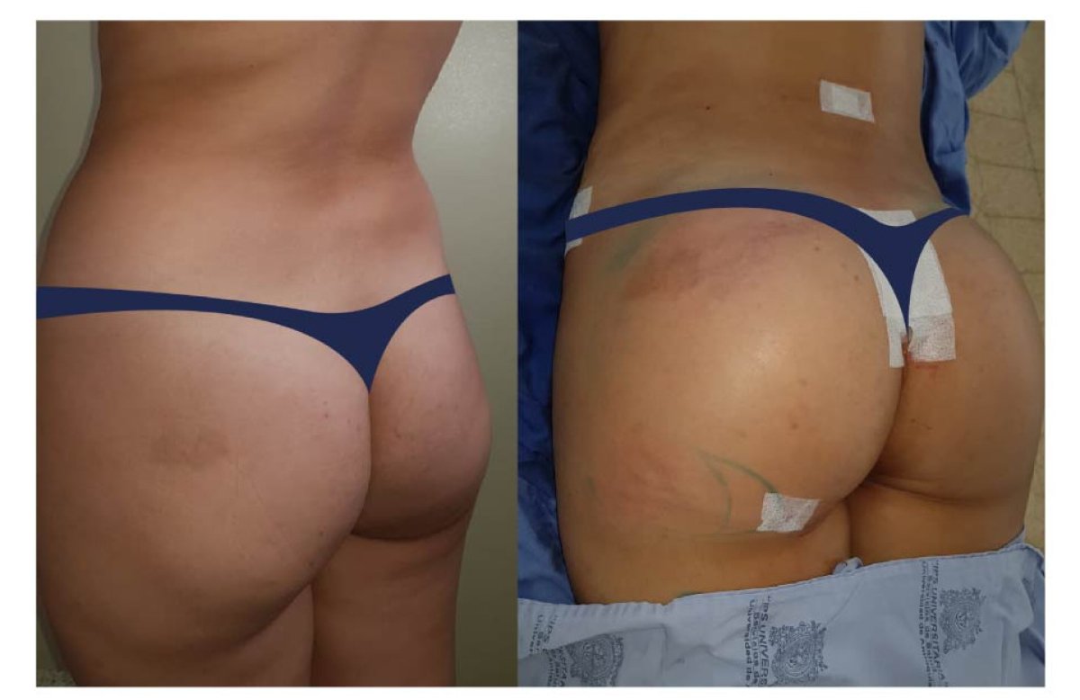 before-after photo