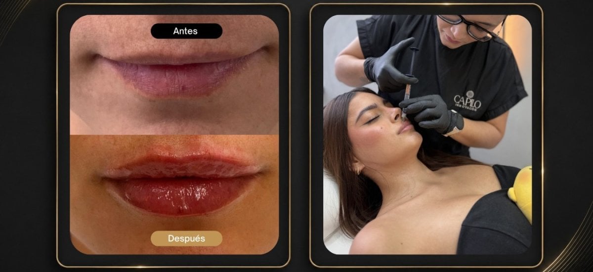 before-after photo