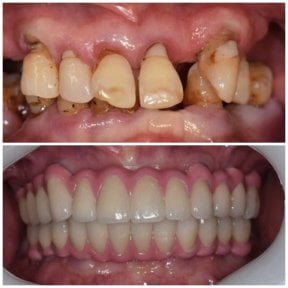 NEW Qinghua Sunshine Dentistry (Wuhan)