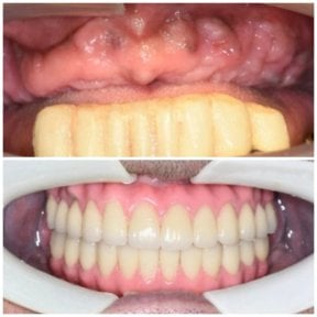 NEW Qinghua Sunshine Dentistry (Wuhan)