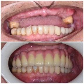 NEW Qinghua Sunshine Dentistry (Wuhan)